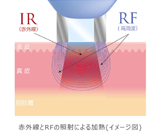赤外線とRFの照射による加熱(イメージ図)